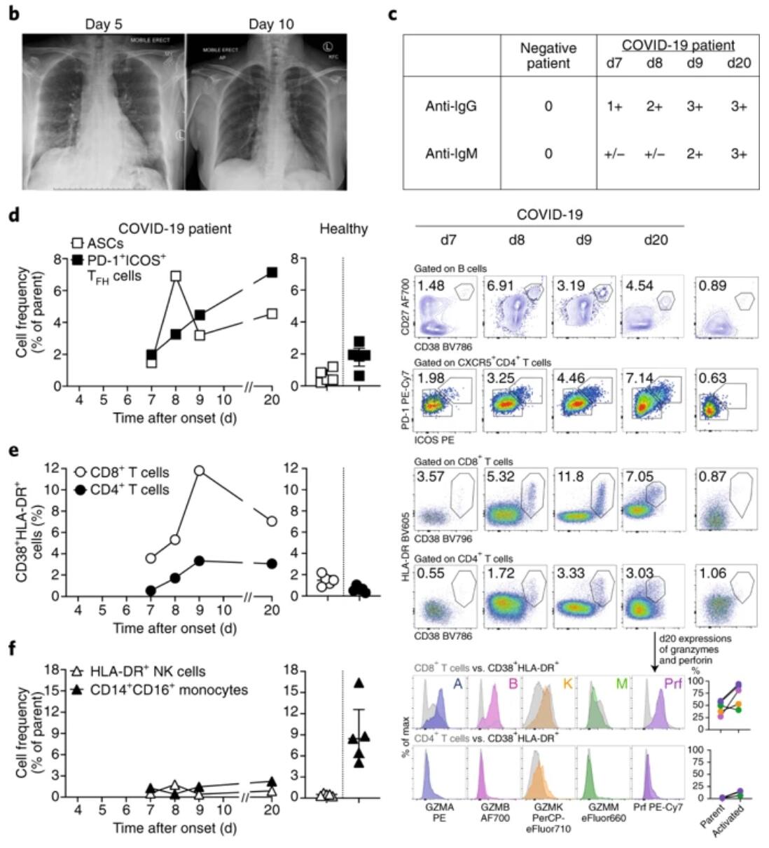 Researchers discover how the body kills coronavirus