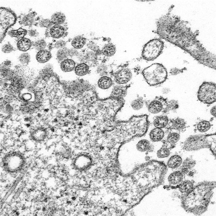US CDC releases unmodified images of new coronavirus