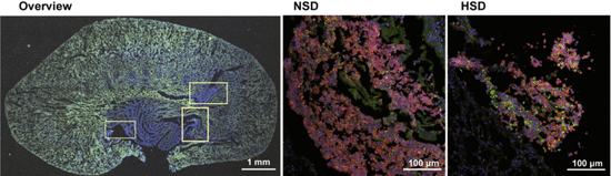 Salty food will reduce immunity, study says