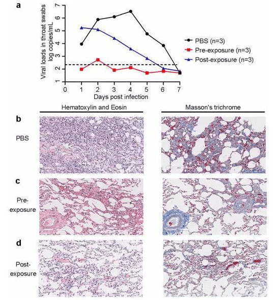 Chinese scientists find potent coronavirus-neutralizing antibody