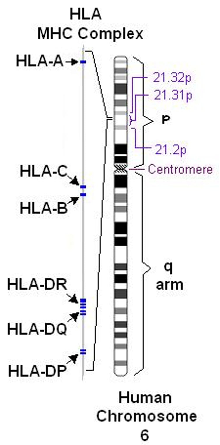Your genes could determine whether the coronavirus puts you in the hospital